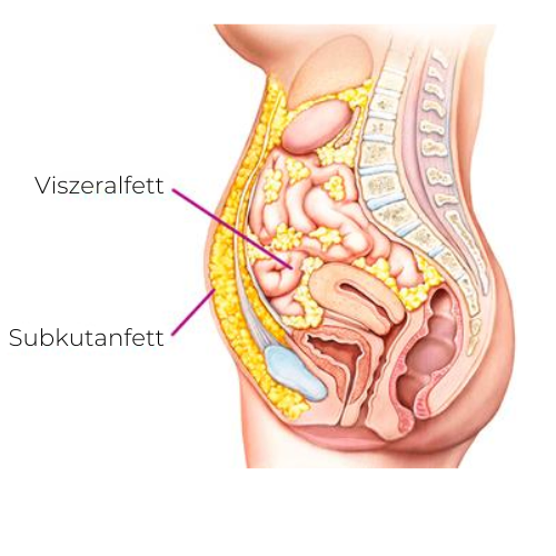Grafische Darstellung von Viszeralfett und Subkutanfett.
