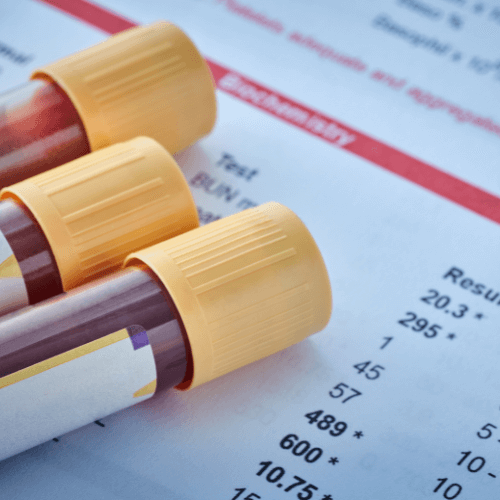 Vollblutanalyse als Teil der Mikronährstoffanalyse.
