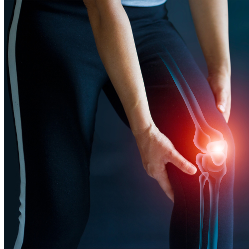 Person hält ihr schmerzendes Knie fest.